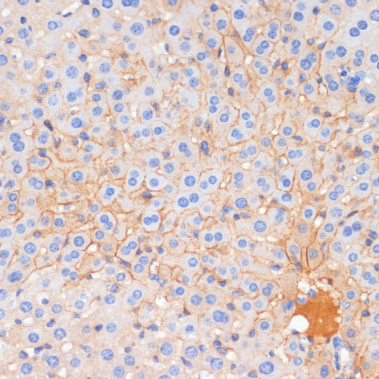 E-Cadherin Rabbit Polyclonal Antibody - Image 4
