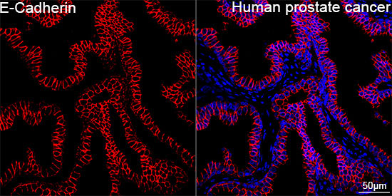 E-Cadherin Rabbit Polyclonal Antibody - Image 5