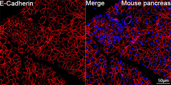 E-Cadherin Rabbit Polyclonal Antibody - Image 6
