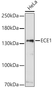 ECE1 Rabbit Polyclonal Antibody