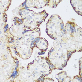 ECH1 Rabbit Polyclonal Antibody - Image 3