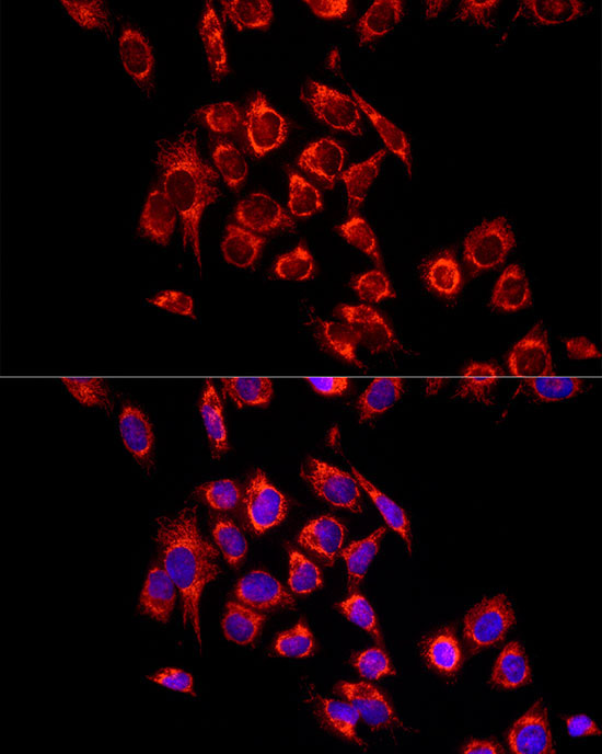 ECHS1 Rabbit Polyclonal Antibody - Image 2