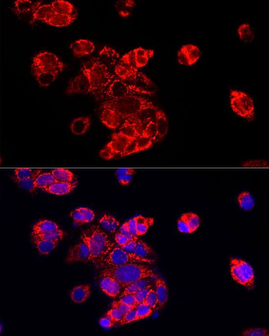 ECHS1 Rabbit Polyclonal Antibody - Image 3