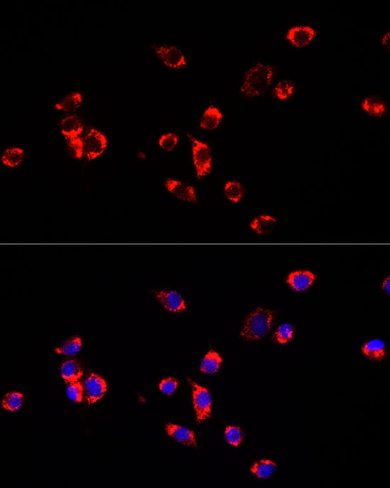 ECHS1 Rabbit Polyclonal Antibody - Image 4