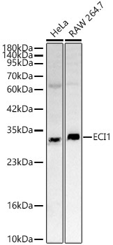 ECI1 Rabbit Polyclonal Antibody