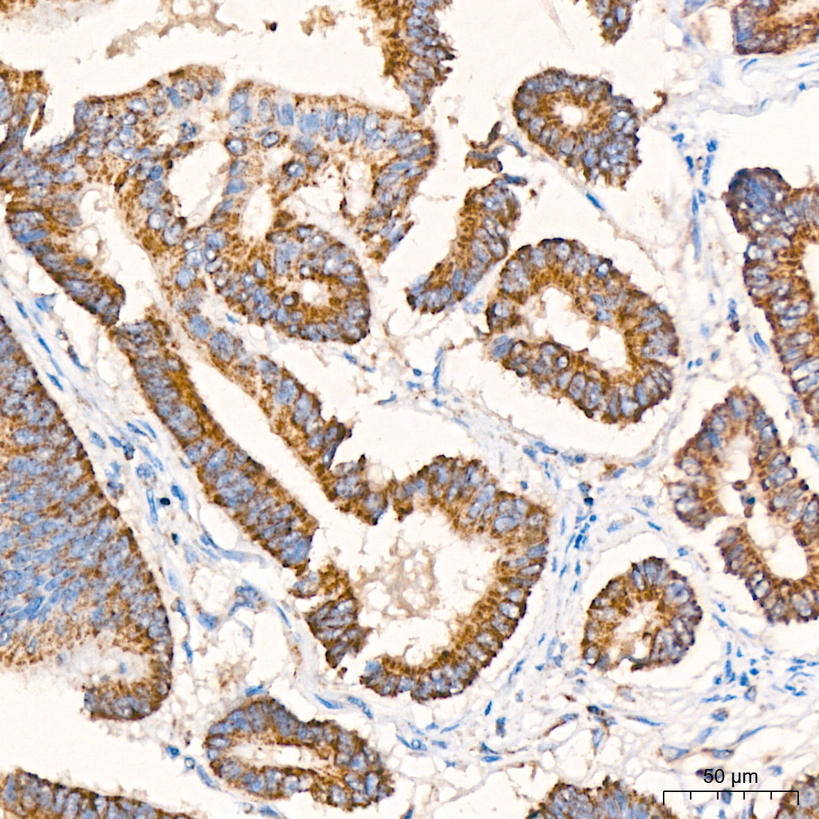 ECI1 Rabbit Polyclonal Antibody - Image 2