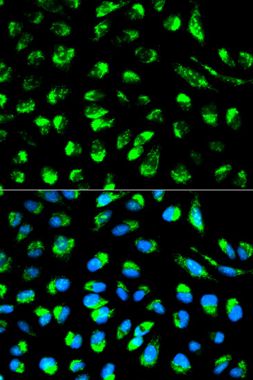 ECI1 Rabbit Polyclonal Antibody - Image 3