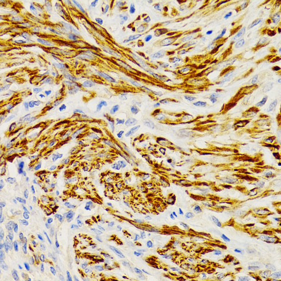EDA Rabbit Polyclonal Antibody - Image 2