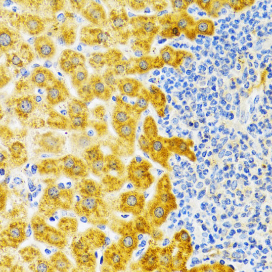 EDA Rabbit Polyclonal Antibody - Image 3