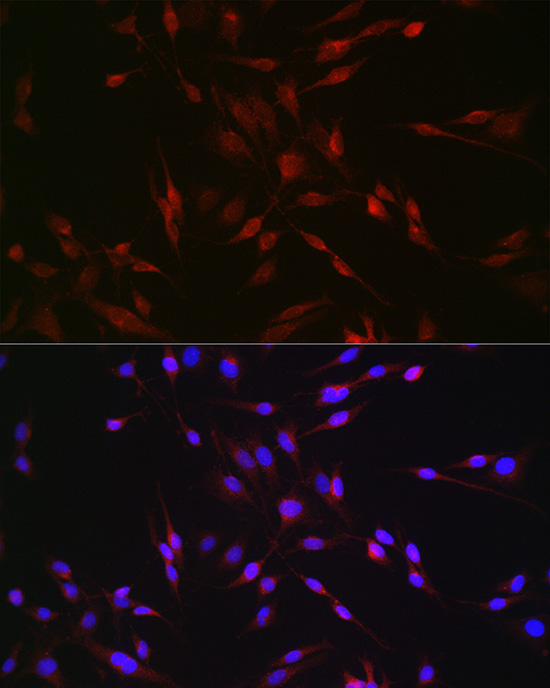 EDA Rabbit Polyclonal Antibody - Image 5