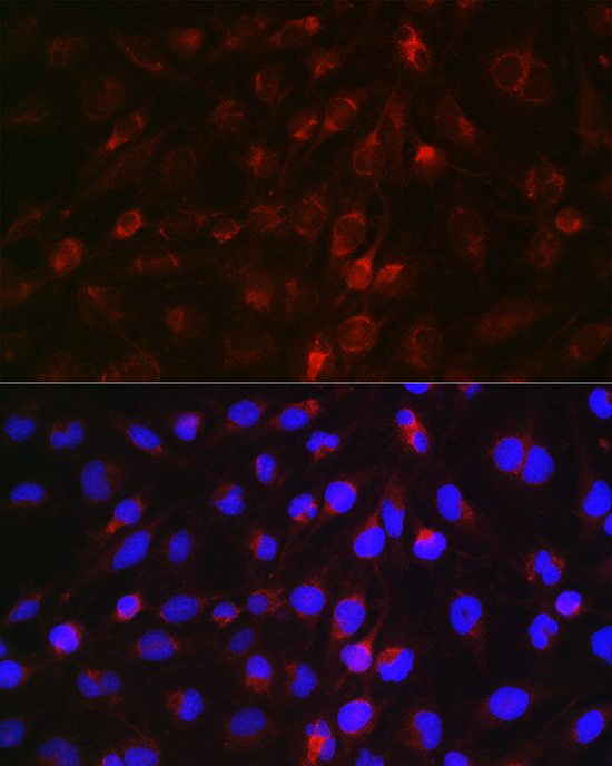 EDA Rabbit Polyclonal Antibody - Image 7