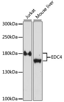 EDC4 Rabbit Polyclonal Antibody