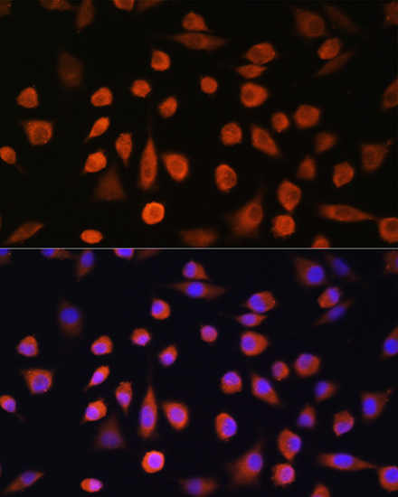 EDEM2 Rabbit Polyclonal Antibody - Image 2