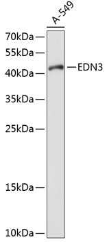 EDN3 Rabbit Polyclonal Antibody