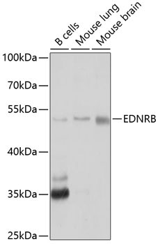 EDNRB Rabbit Polyclonal Antibody