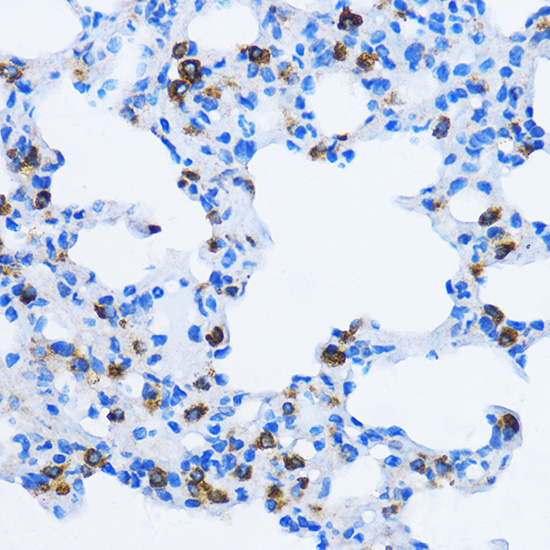 EEA1 Rabbit Polyclonal Antibody - Image 2