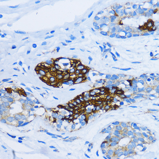 EEA1 Rabbit Polyclonal Antibody - Image 3