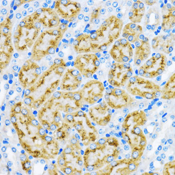 EEA1 Rabbit Polyclonal Antibody - Image 4