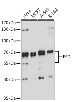 EED Rabbit Polyclonal Antibody