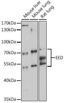 EED Rabbit Polyclonal Antibody - Image 2