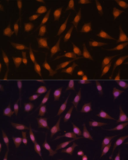 EED Rabbit Polyclonal Antibody - Image 3