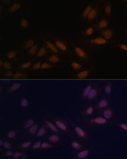 EED Rabbit Polyclonal Antibody - Image 4