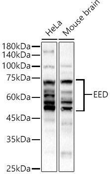 EED Rabbit Polyclonal Antibody