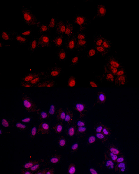 EED Rabbit Polyclonal Antibody - Image 2