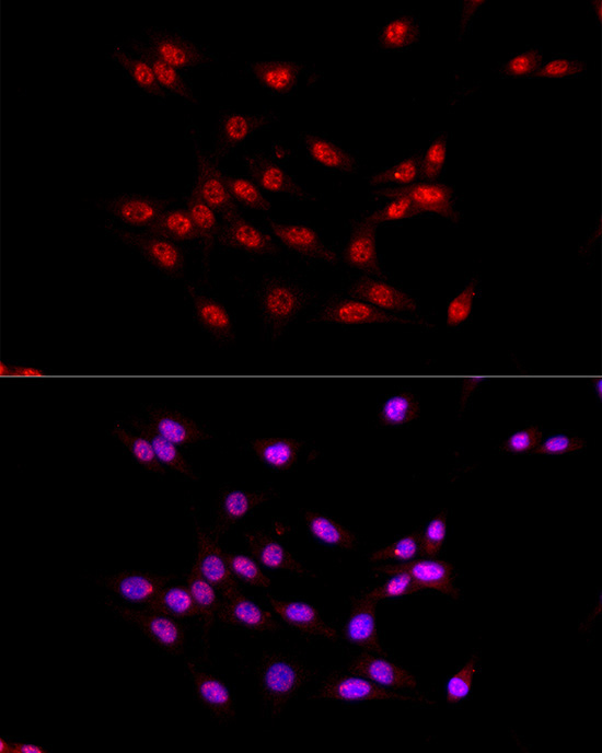 EED Rabbit Polyclonal Antibody - Image 3
