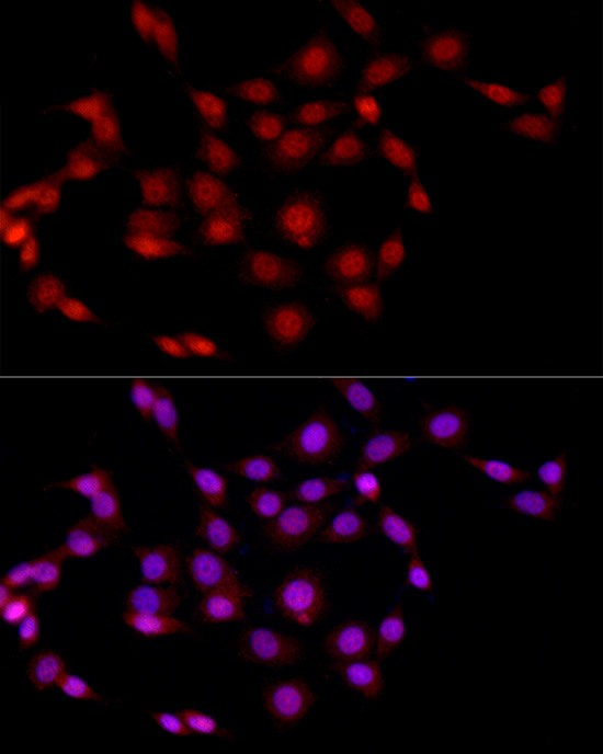 EED Rabbit Polyclonal Antibody - Image 4