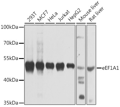 eEF1A1 Rabbit Polyclonal Antibody