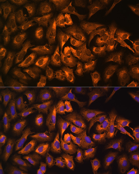 eEF1A1 Rabbit Polyclonal Antibody - Image 2