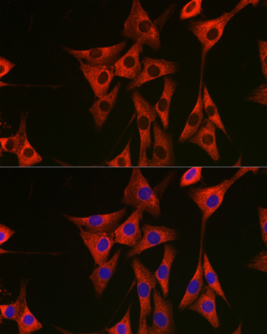 eEF1A1 Rabbit Polyclonal Antibody - Image 10