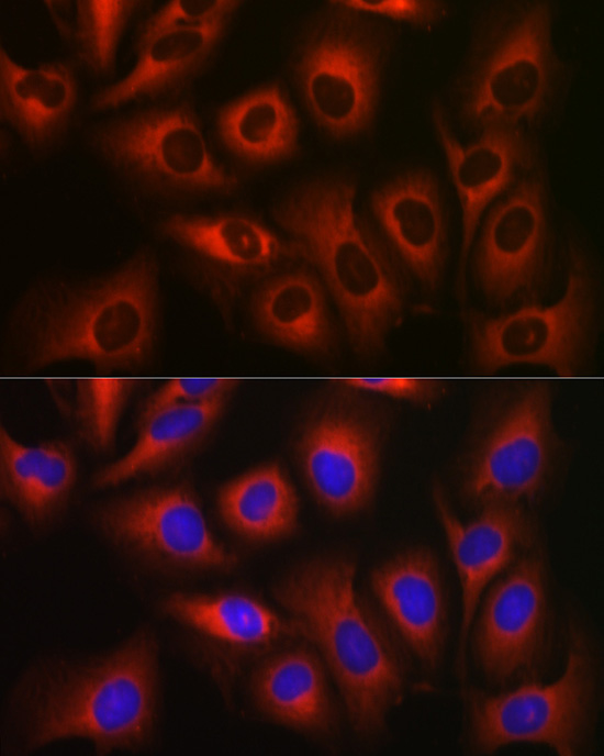 eEF1A1 Rabbit Polyclonal Antibody - Image 11