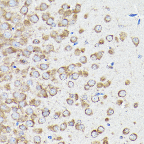 eEF1A1 Rabbit Polyclonal Antibody - Image 3