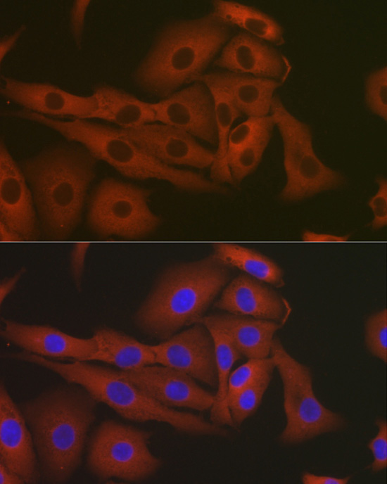 eEF1A1 Rabbit Polyclonal Antibody - Image 7