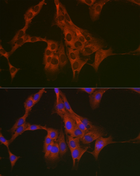eEF1A1 Rabbit Polyclonal Antibody - Image 8