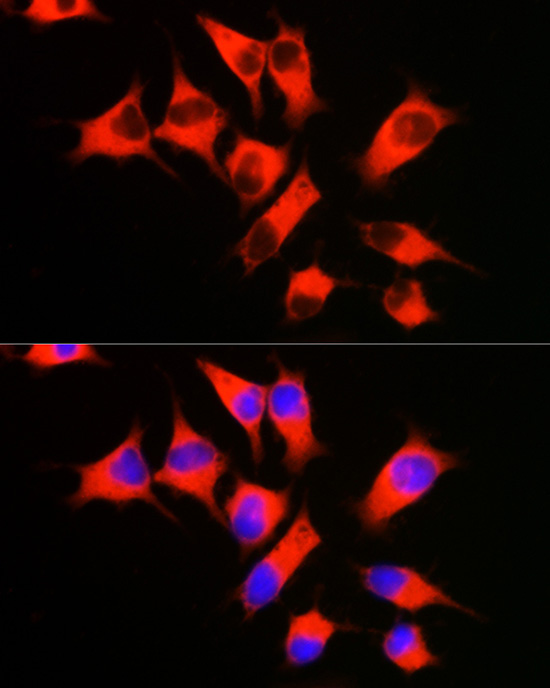 eEF1A1 Rabbit Polyclonal Antibody - Image 9