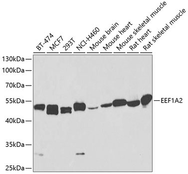 EEF1A2 Rabbit Polyclonal Antibody
