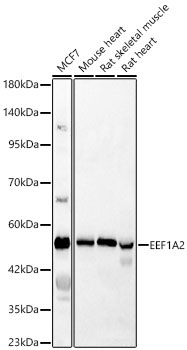 EEF1A2 Rabbit Polyclonal Antibody