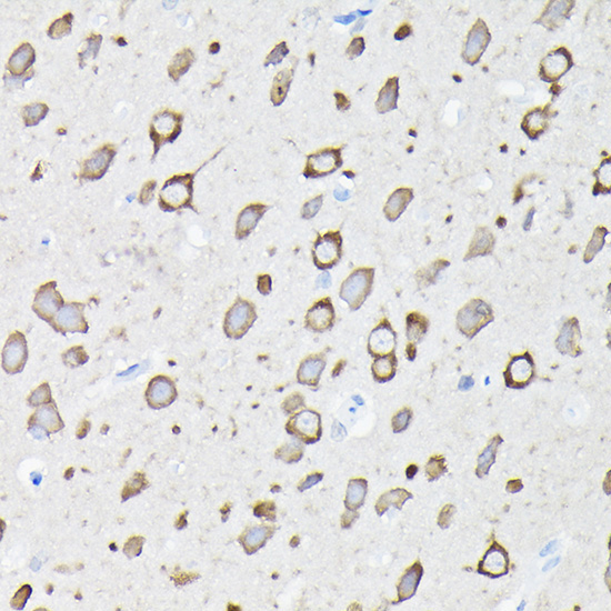 EEF1A2 Rabbit Polyclonal Antibody - Image 2