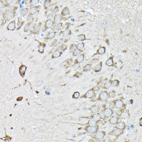 EEF1A2 Rabbit Polyclonal Antibody - Image 3