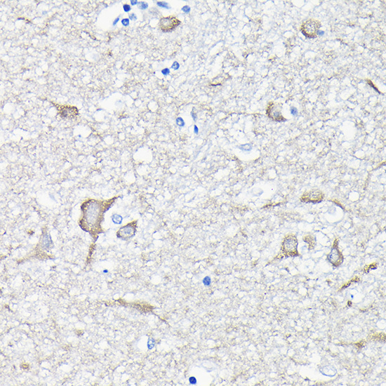 EEF1A2 Rabbit Polyclonal Antibody - Image 4