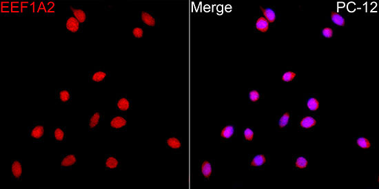 EEF1A2 Rabbit Polyclonal Antibody - Image 6