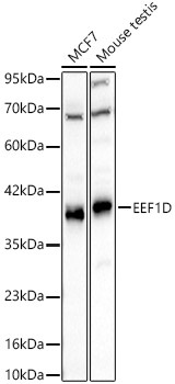 EEF1D Rabbit Polyclonal Antibody