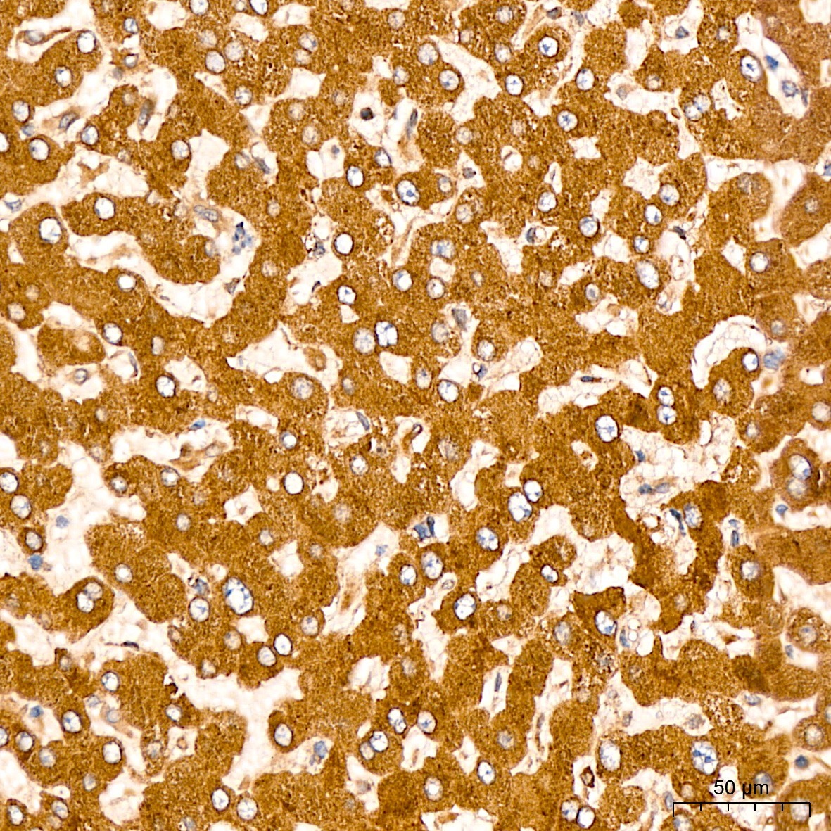 EEF1D Rabbit Polyclonal Antibody - Image 2