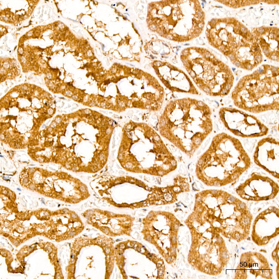 EEF1D Rabbit Polyclonal Antibody - Image 3