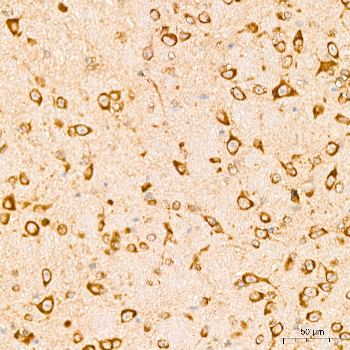 EEF1D Rabbit Polyclonal Antibody - Image 4