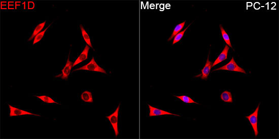 EEF1D Rabbit Polyclonal Antibody - Image 7
