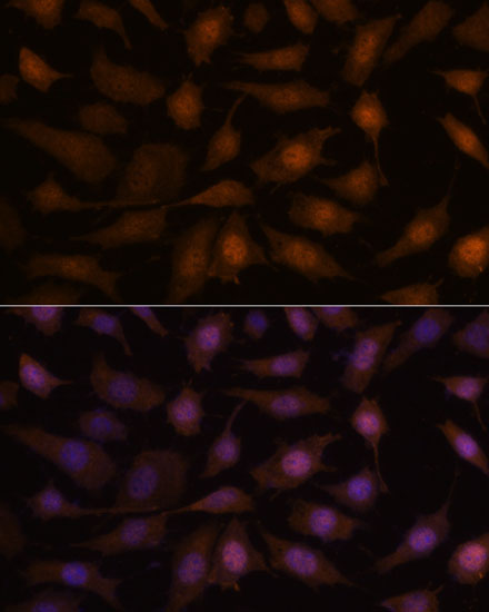 EEF1E1 Rabbit Polyclonal Antibody - Image 2